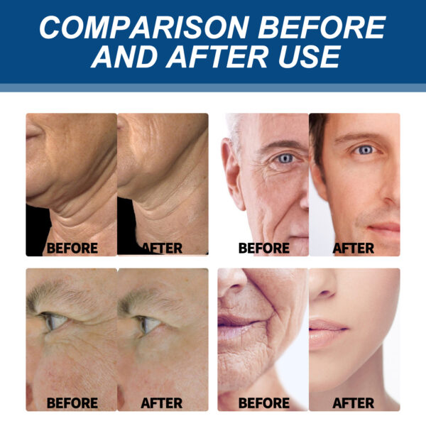 East Moon Collagen Cream, Fade Fine Lines Wrinkle Tight Facial Skin Moisturizing Anti-Aging Cream - Image 8